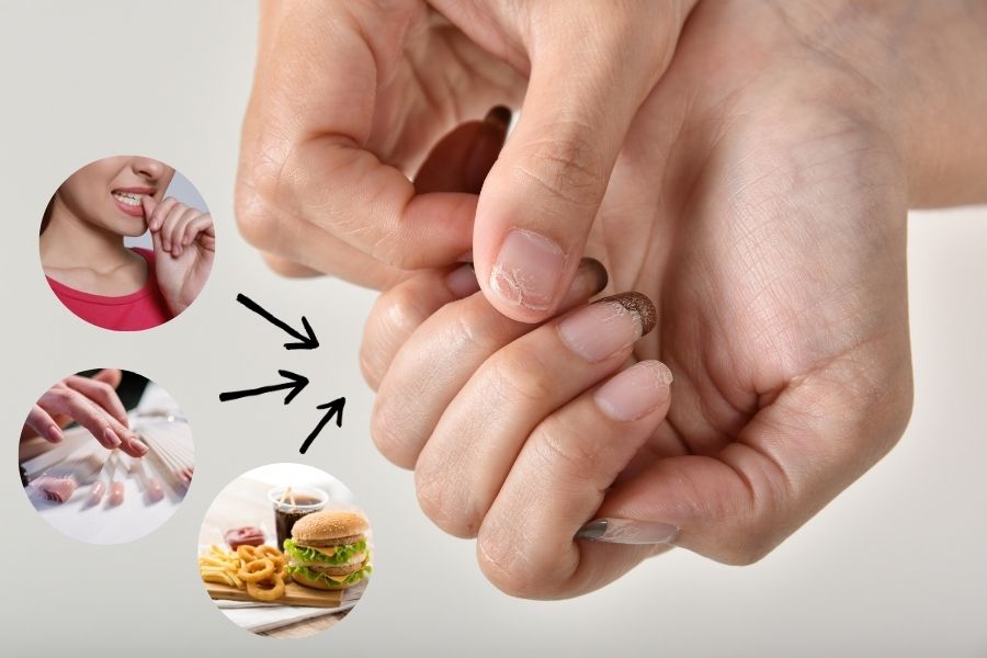 Xác định đúng nguyên nhân giúp bạn chọn được cách dưỡng móng tay phù hợp