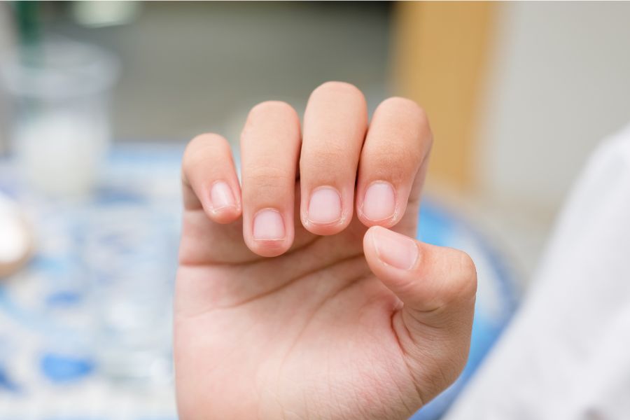 Hiểu rõ nguyên nhân giúp bạn chọn được cách nuôi móng tay dài nhanh phù hợp