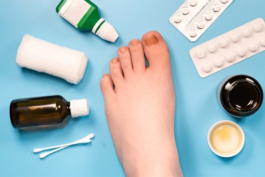 Bạn có thể sử dụng thuốc điều trị tại nhà nếu bị nấm móng hoặc nhiễm khuẩn nhẹ