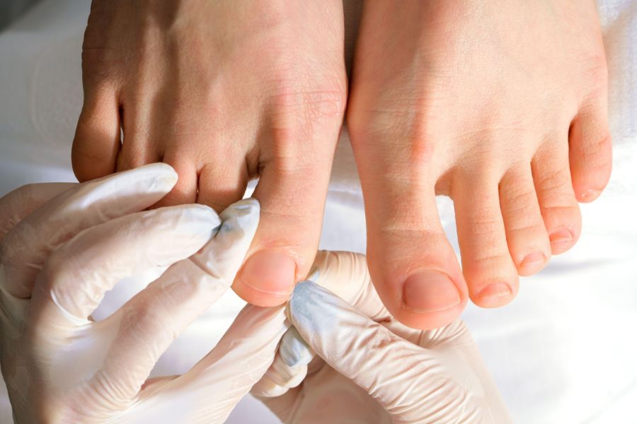 Theo dõi tình trạng móng thường xuyên để kịp thời phát hiện những dấu hiệu bất thường