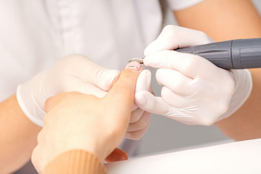 Máy mài chuyên dụng rút ngắn thời gian ủ và dung dịch phá móng giúp tháo móng úp an toàn