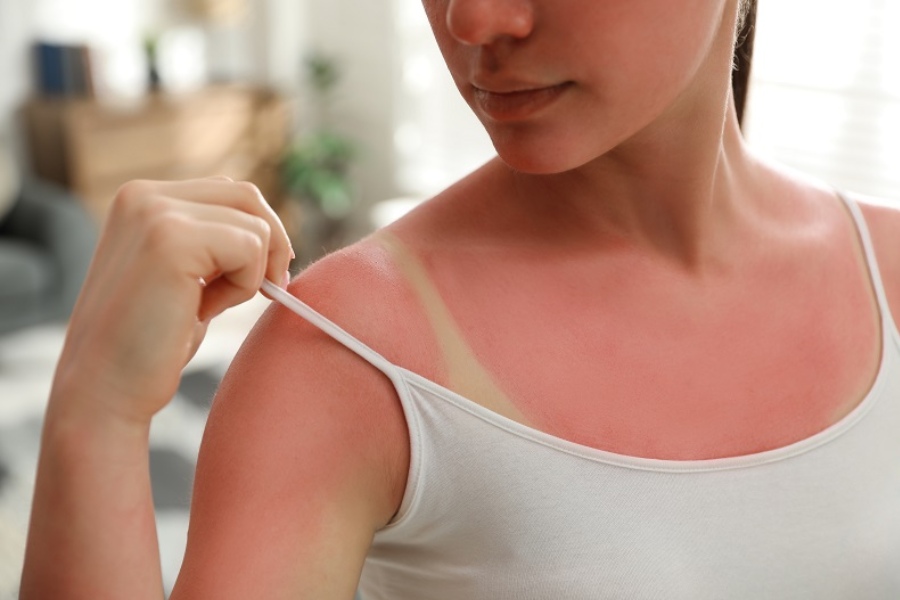 Chống nắng là bước cần thiết trong mọi chu trình chăm sóc da