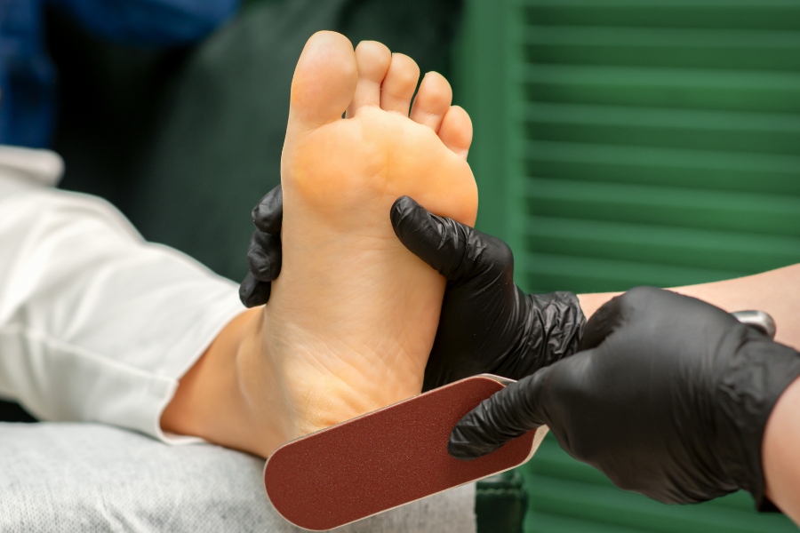 Chà gót chân chuyên sâu, loại bỏ da chai cứng và thô ráp