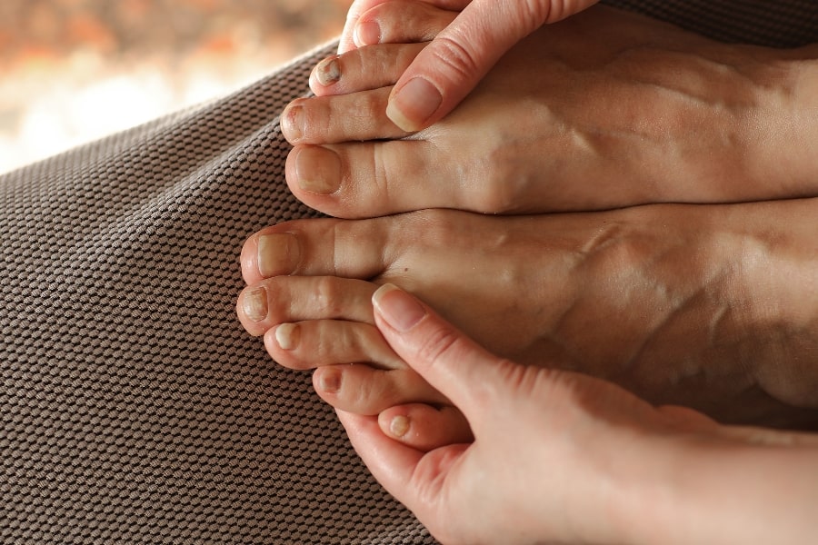 Móng chân có màu sắc bất thường có thể là dấu hiệu bệnh lý