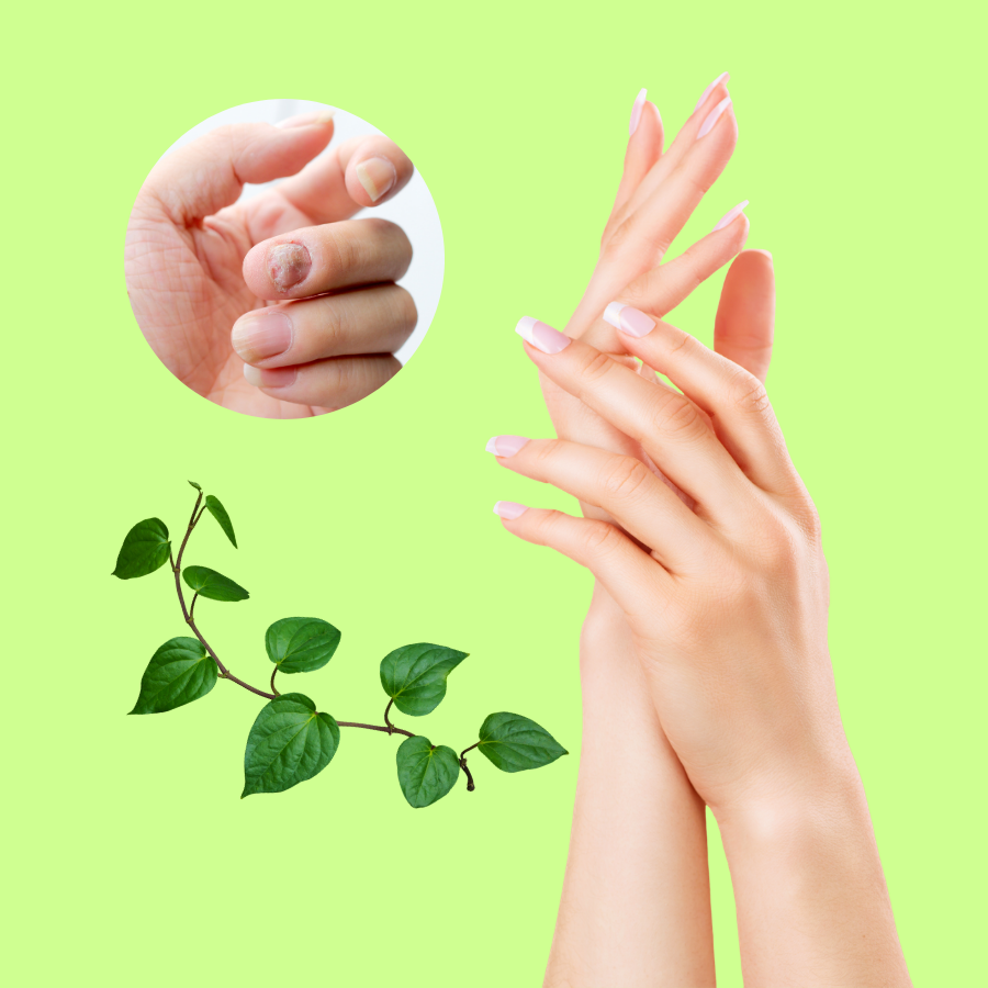 Cách Chữa Nấm Móng Tay Bằng Lá Trầu Không Tại Nhà