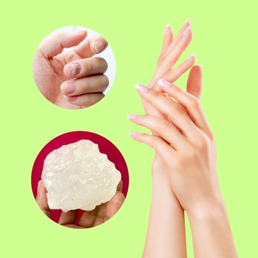 Cách trị nấm móng tay bằng phèn chua: Hướng dẫn chi tiết từ A đến Z