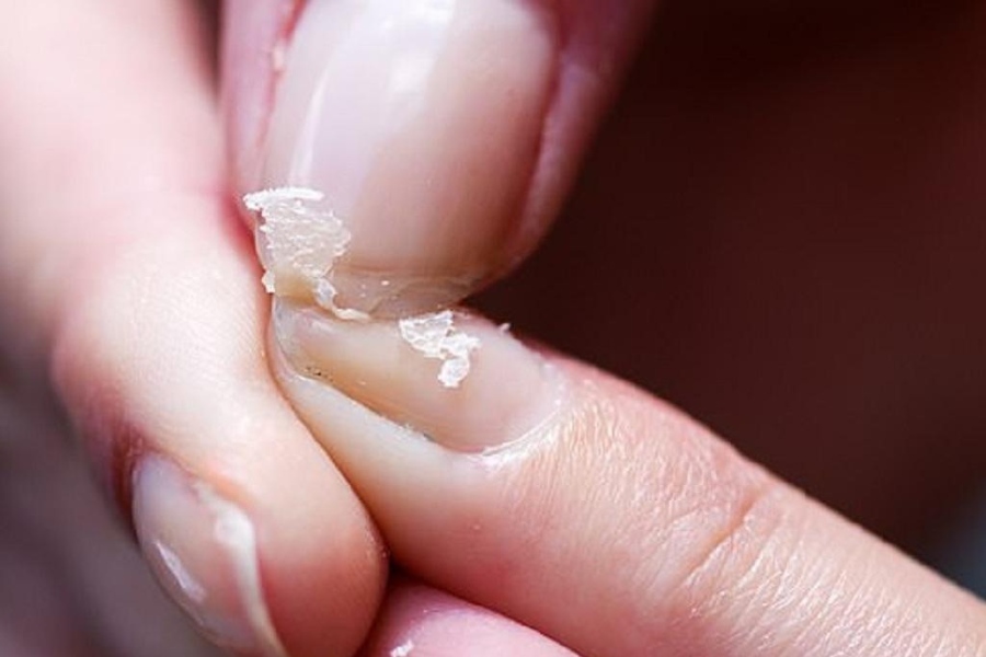 Tùy vào tình trạng móng mà bạn chọn sản phẩm dưỡng phù hợp