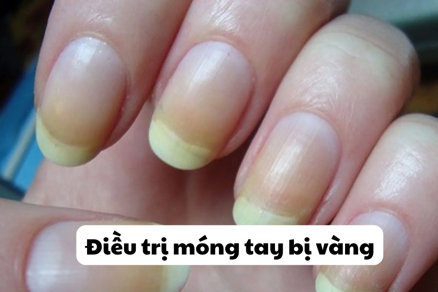 Bạn nên thăm khám bác sĩ để có giải pháp điều trị phù hợp