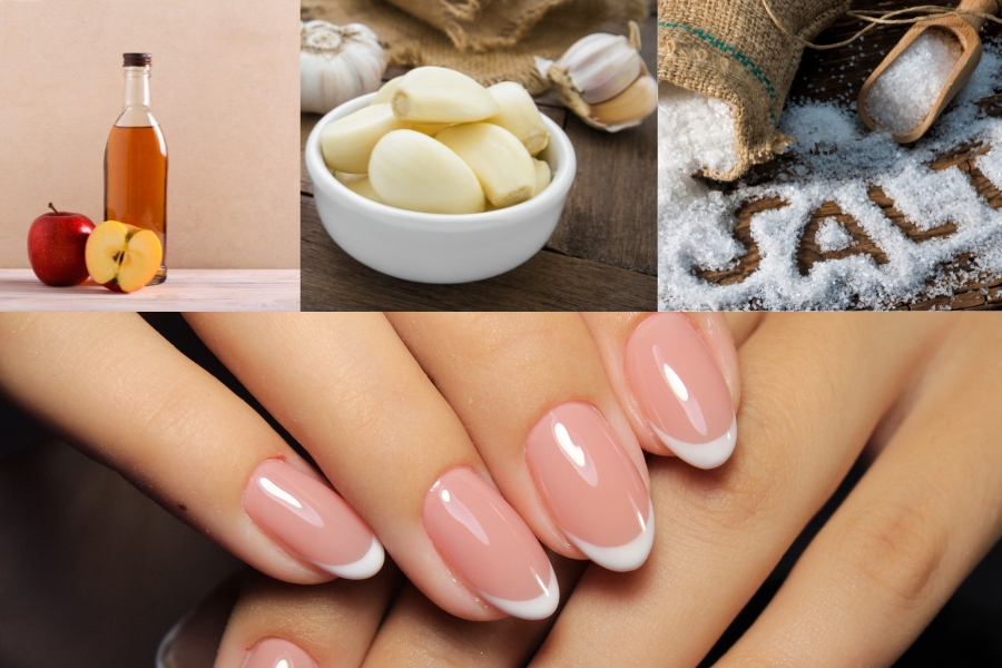 Trong trường hợp nhẹ, bạn có thể điều trị nấm móng tay bằng các mẹo dân gian